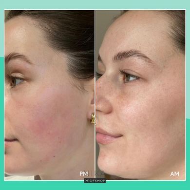 Заспокійлива нічна маска з центнелою Q+A Cica Calming Overnight Face Mask 50gЗаспокійлива нічна маска з центнелою Q+A Cica Calming Overnight Face Mask 50g